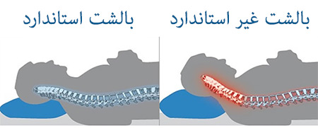 بالشت طبی دالوپ